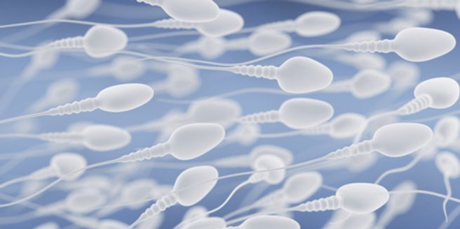 Spermiogramm: Ein Rudel Spermien Spermiogramm: Ein Rudel Spermien