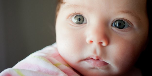 Dennie-Morgan-Falte bei Babys: Das bedeutet sie