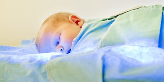 Gelbsucht: Baby in Behandlung Gelbsucht: Baby in Behandlung