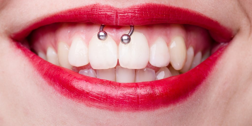 Smiley Piercing So Verschonerst Du Dein Lacheln Desired De