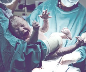 Dieser Geburtstrend bei Kaiserschnitten ist gefährlich