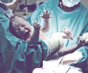 Dieser Geburtstrend bei Kaiserschnitten ist gefährlich