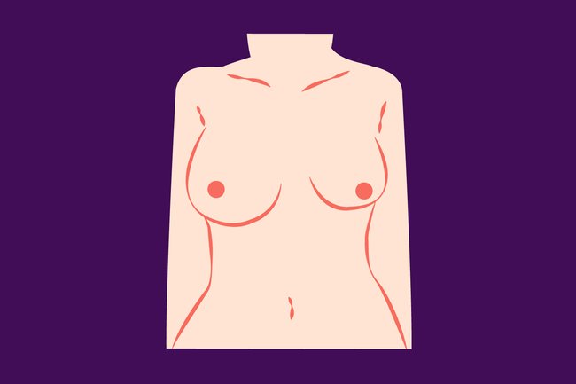 Asymmetrische Brust