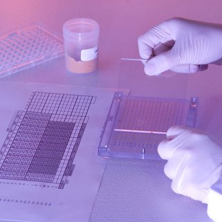 Blastozystentransfer: Eine Mglichkeit der knstlichen Befruchtung