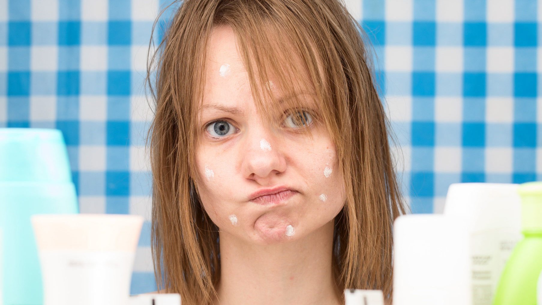 11 ultimative Tipps gegen Pickel und Mitesser