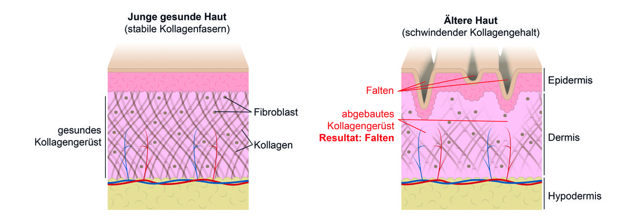 ELASTEN ELASTEN