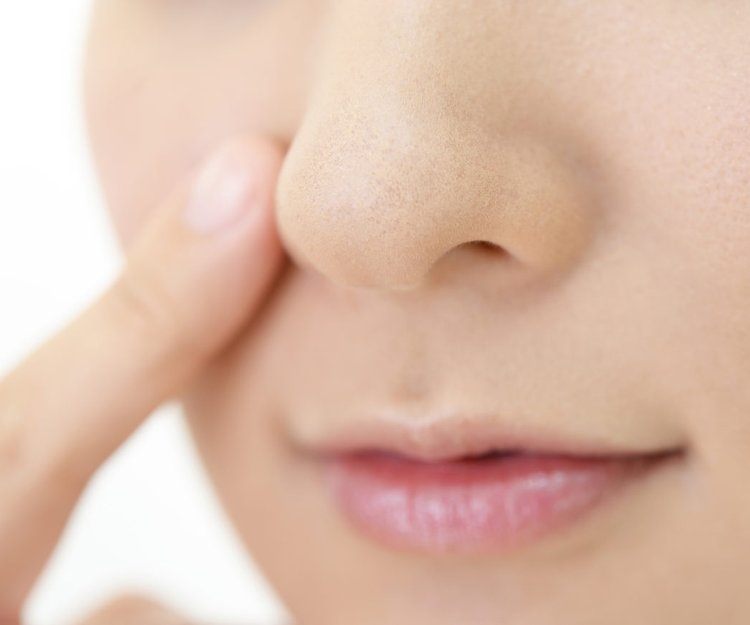 5 Wege Mitesser Auf Der Nase Loszuwerden Desired De