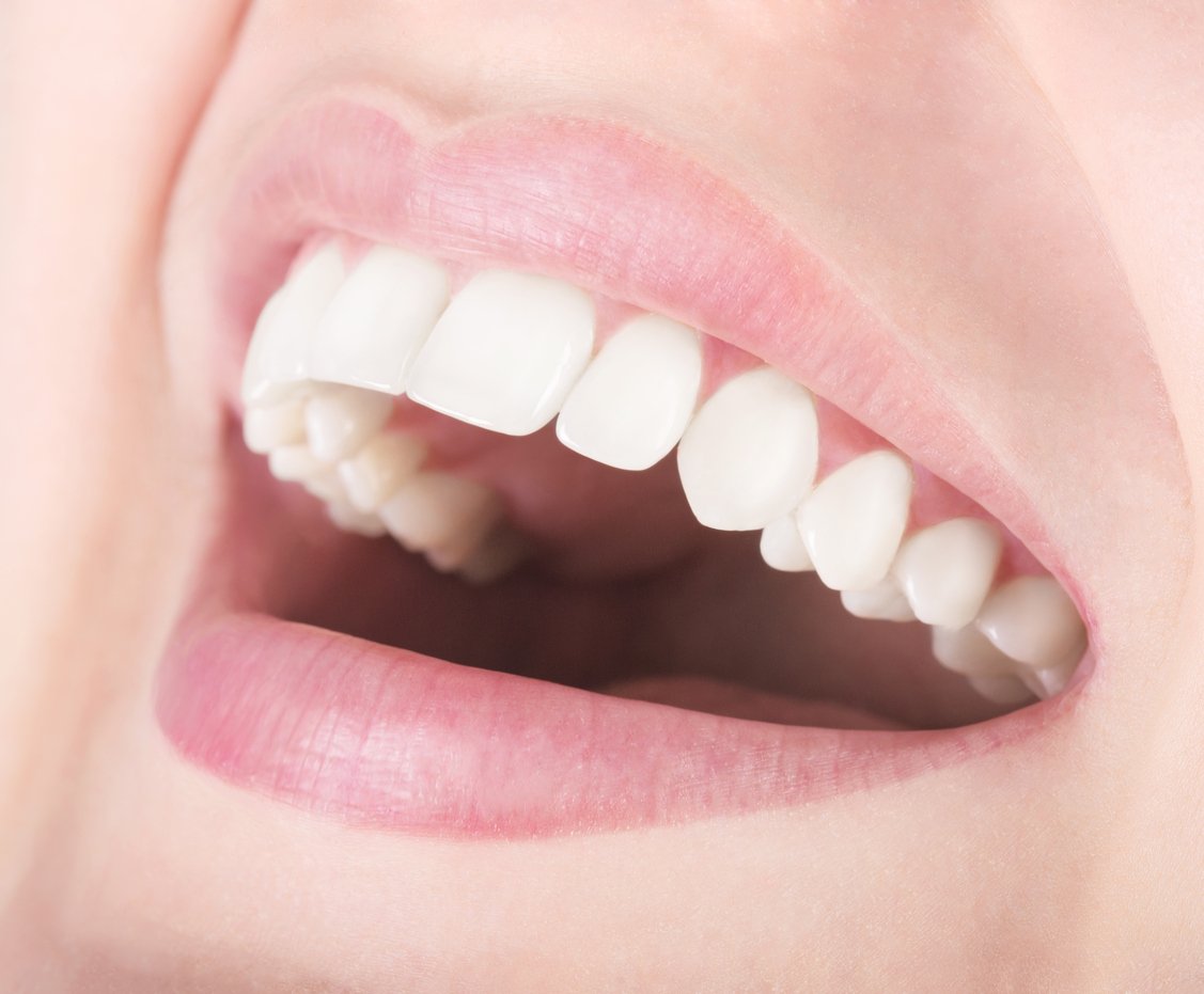 Weiße Zähne mit Aktivkohle-Zahnpasta