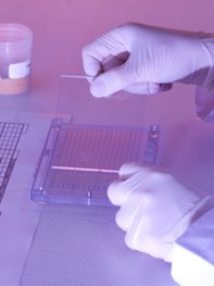Unerfüllter Kinderwunsch: Blastozystentransfer kann helfen. Unerfüllter Kinderwunsch: Blastozystentransfer kann helfen.
