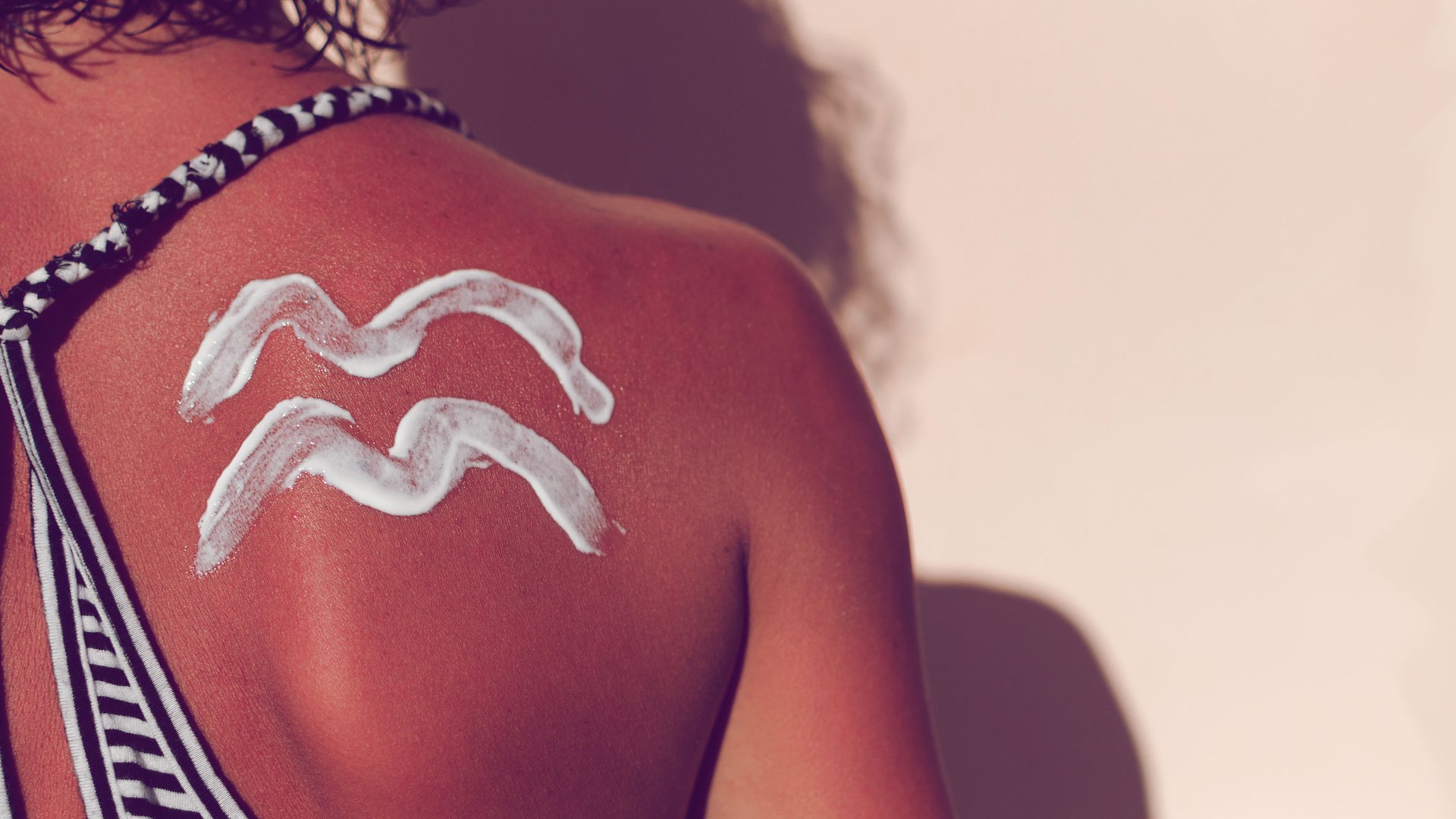 Diese-Hausmittel-helfen-sofort-gegen-Sonnenbrand