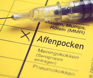 Affenpocken: Karl Lauterbach bestellt 40.000 Dosen Impfstoff