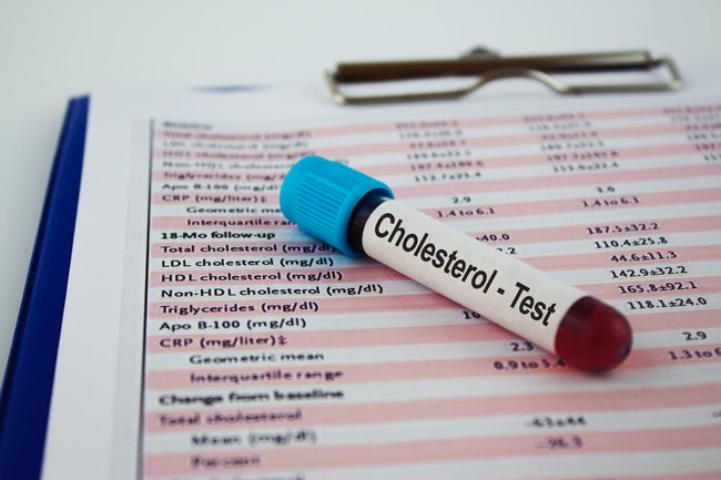 Choelsterinarme Ernährung - Cholesterol-Test