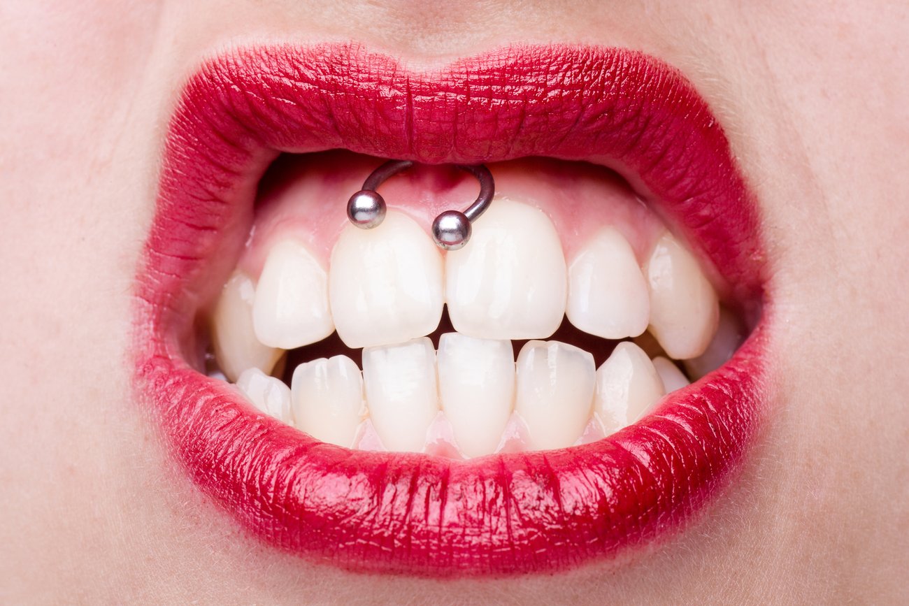 Smiley-Piercing: So verschönerst du dein Lächeln