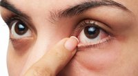 7 Hausmittel gegen trockene Augen, die wirklich helfen
