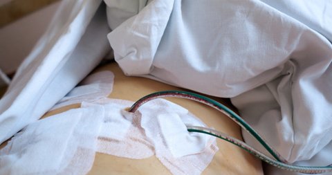 Diät durch Magensonde verflüssigt
