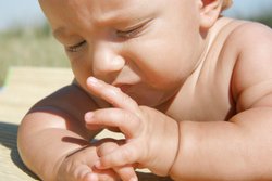 Was tun bei Sonnenbrand beim Baby Was tun bei Sonnenbrand beim Baby