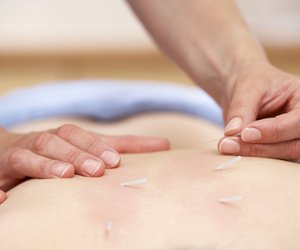 Mit Akupunktur zur Schwangerschaft