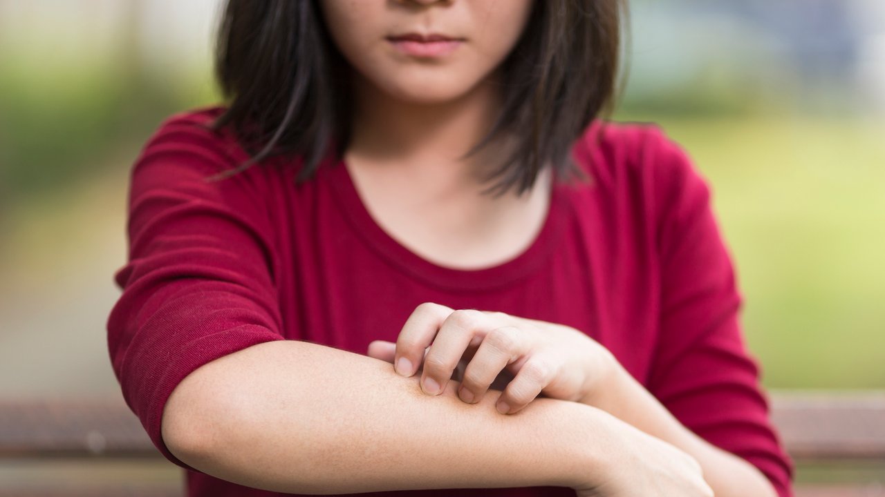 Krätze bei Kindern wieder häufiger