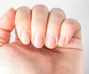 Krankheiten an den Fingernägeln erkennen: Diese 10 Zeichen solltest du beachten