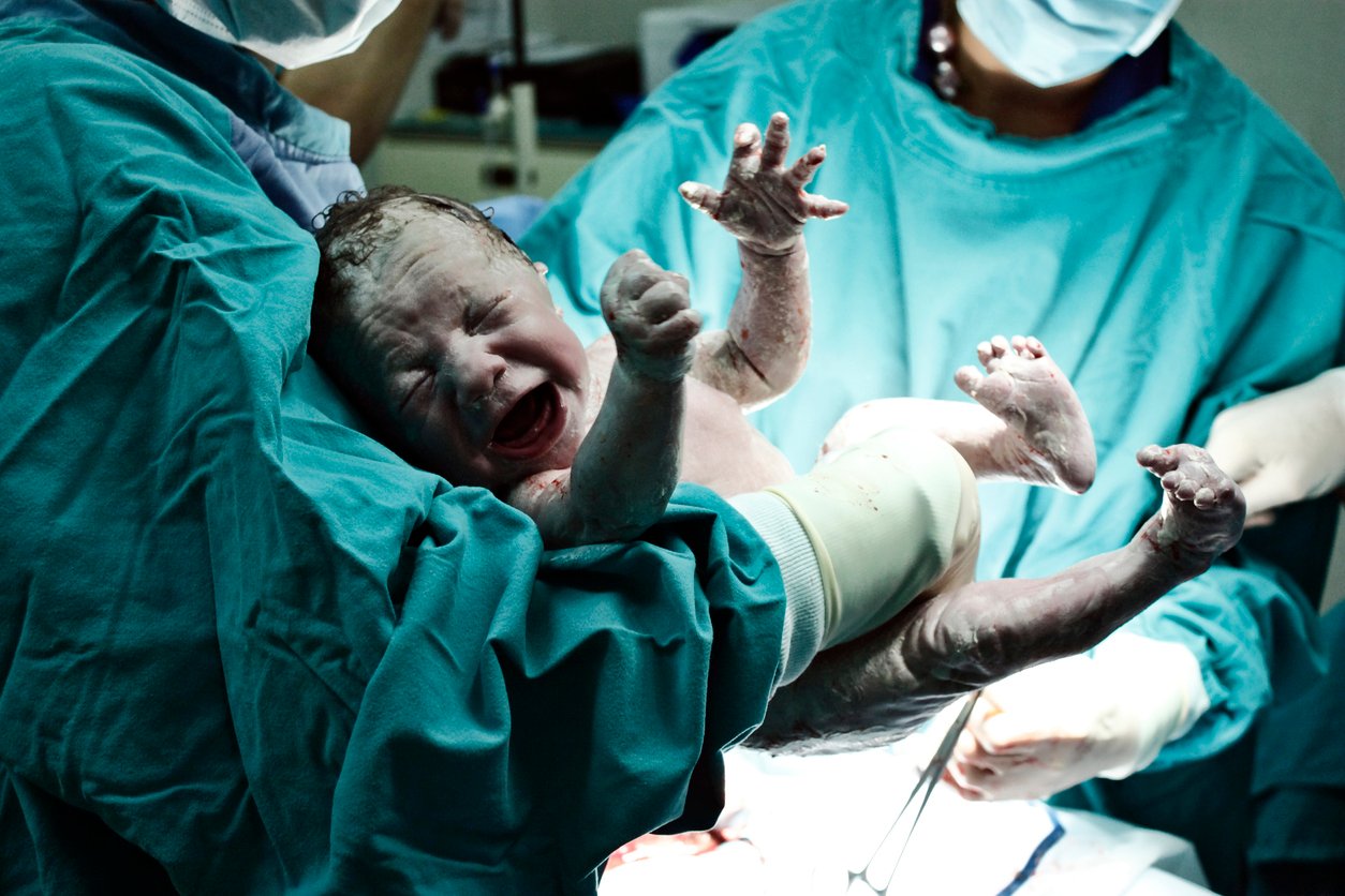 Geburtstrauma beim Baby
