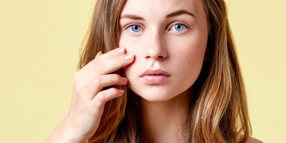 Pickel Am Auge Loswerden Das Hilft Garantiert Desired De