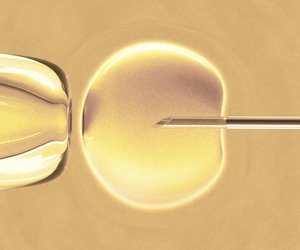 IVF: In-vitro-Fertilisation