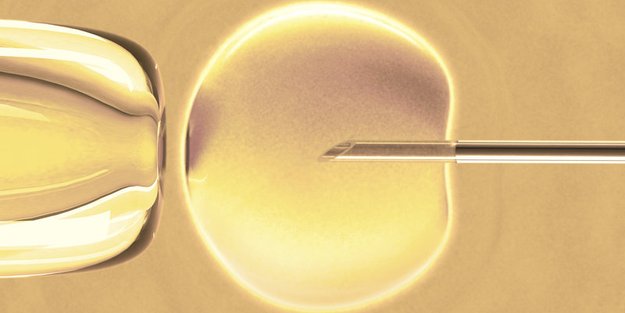 IVF: In-vitro-Fertilisation