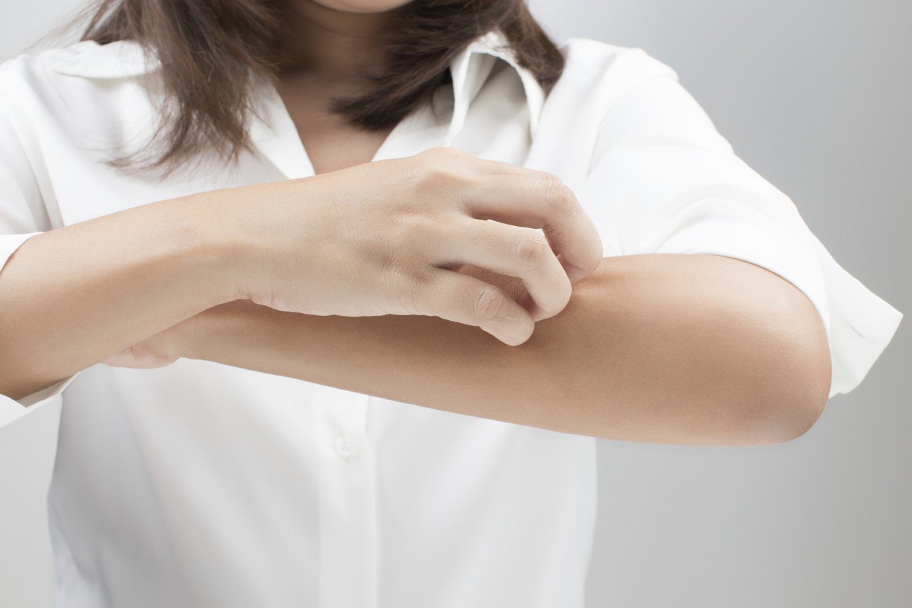 Schädlich für die Haut: Was ist Skin-Picking?