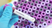 Coronavirus: Aktuelle Zahlen und wie du dich schützen kannst