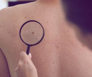 Fibrom selbst entfernen – wann solltest du zum Arzt gehen?