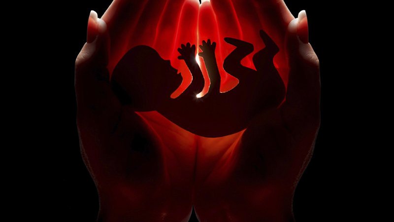 Schwangerschaftsabbruch