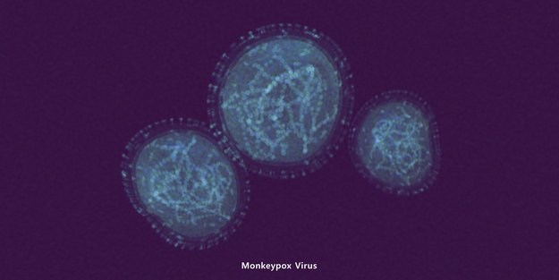 Affenpocken breiten sich aus: Diese Fakten zum Virus musst du kennen