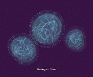 Affenpocken breiten sich aus: Diese Fakten zum Virus musst du kennen
