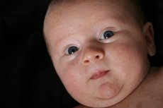 11 Tipps Gegen Hitzepickel Beim Baby Oder Kleinkind Desired De