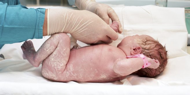 Der Apgar-Score: Baby wird untersucht. Der Apgar-Score: Baby wird untersucht.
